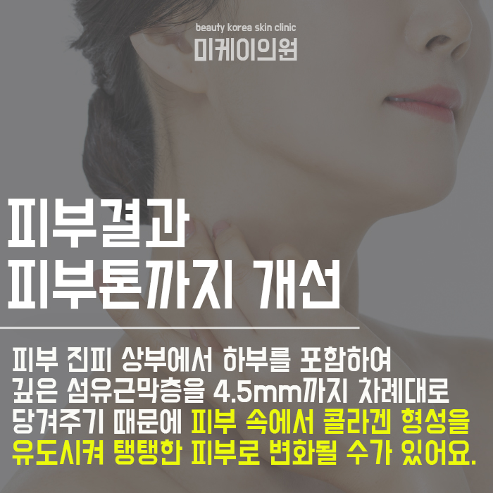 미케이의원 슈링크로 처진 턱선 개선 관련 이미지 2