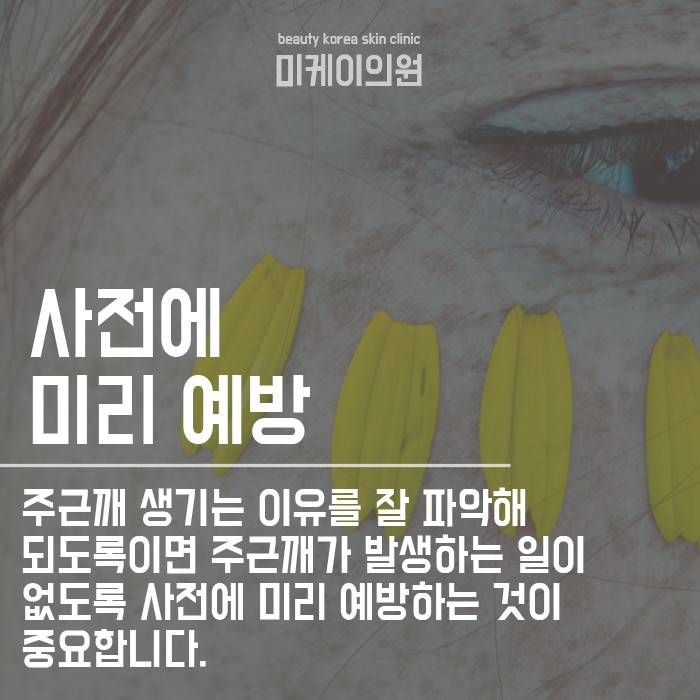 서초구피부과 주근깨 생기는 이유 및 없애는 법 관련 이미지 2