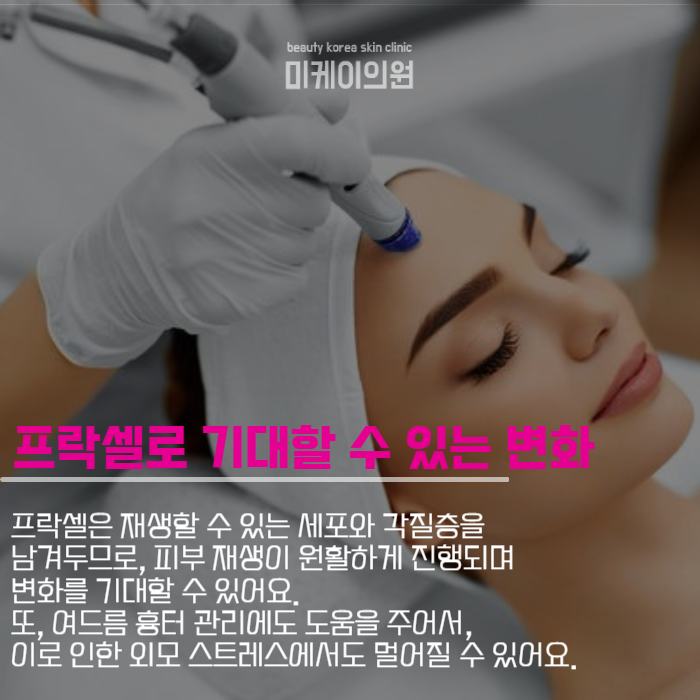 프락셀레이저 통증 부터 원리까지 관련 이미지 3