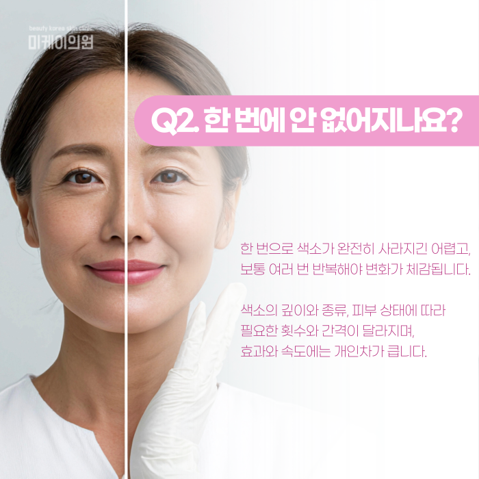 강남 레이저토닝, 한 번에 안 없어지는 이유는? 관련 이미지 3