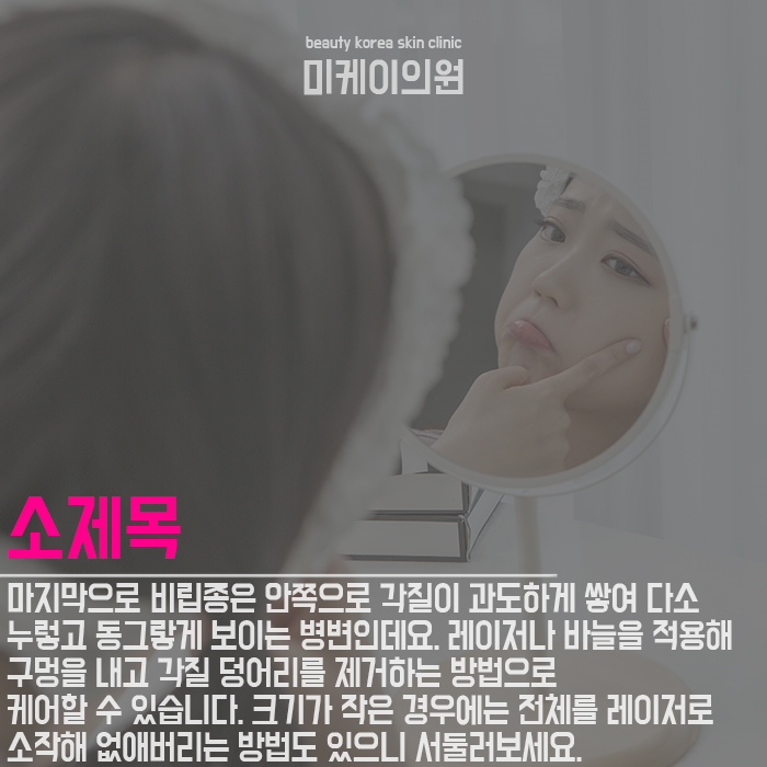 피부사마귀치료 사소한 증상도 무시할 수 없어요 관련 이미지 4