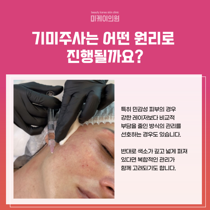 서초역 피부과의원 기미 고민이 깊어질 때 맞는 주사 관련 이미지 2