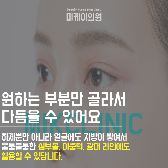 다리지방분해주사 늘씬한 하체라인 만들기 관련 이미지 3