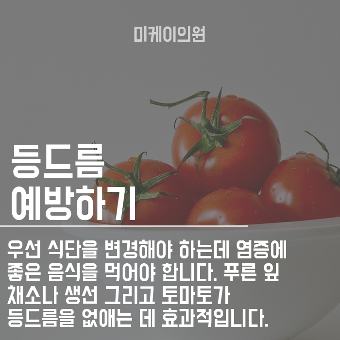 등드름 원인 안 보이는 곳도 중요하다 관련 이미지 4
