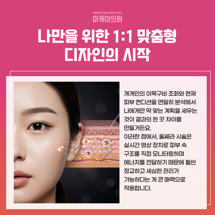 강남 울쎄라 추천 꼭 체크해야 할 리프팅 가이드 관련 이미지 2