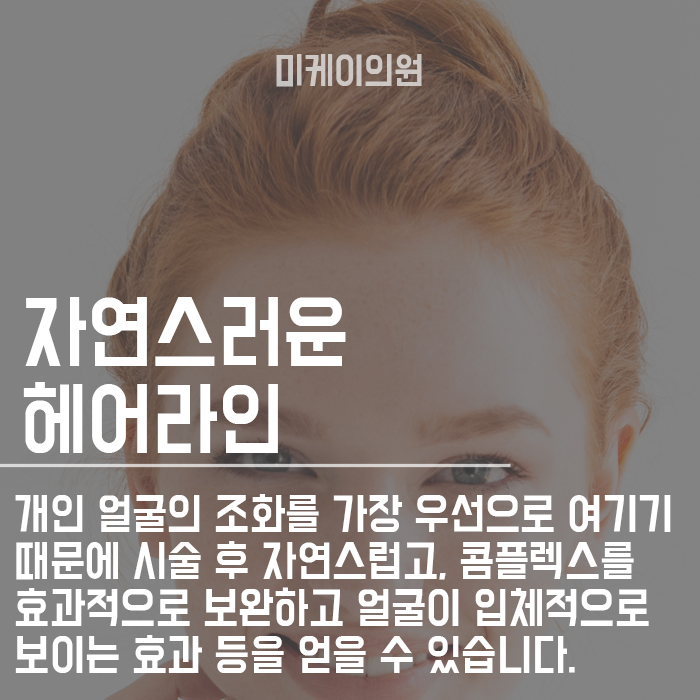 강남헤어라인교정 자연스럽게 받을 수 있는 곳 관련 이미지 6