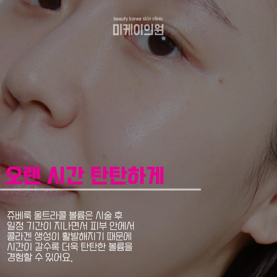 쥬베룩 울트라콜 볼륨으로 자연스러운 볼륨을 관련 이미지 3