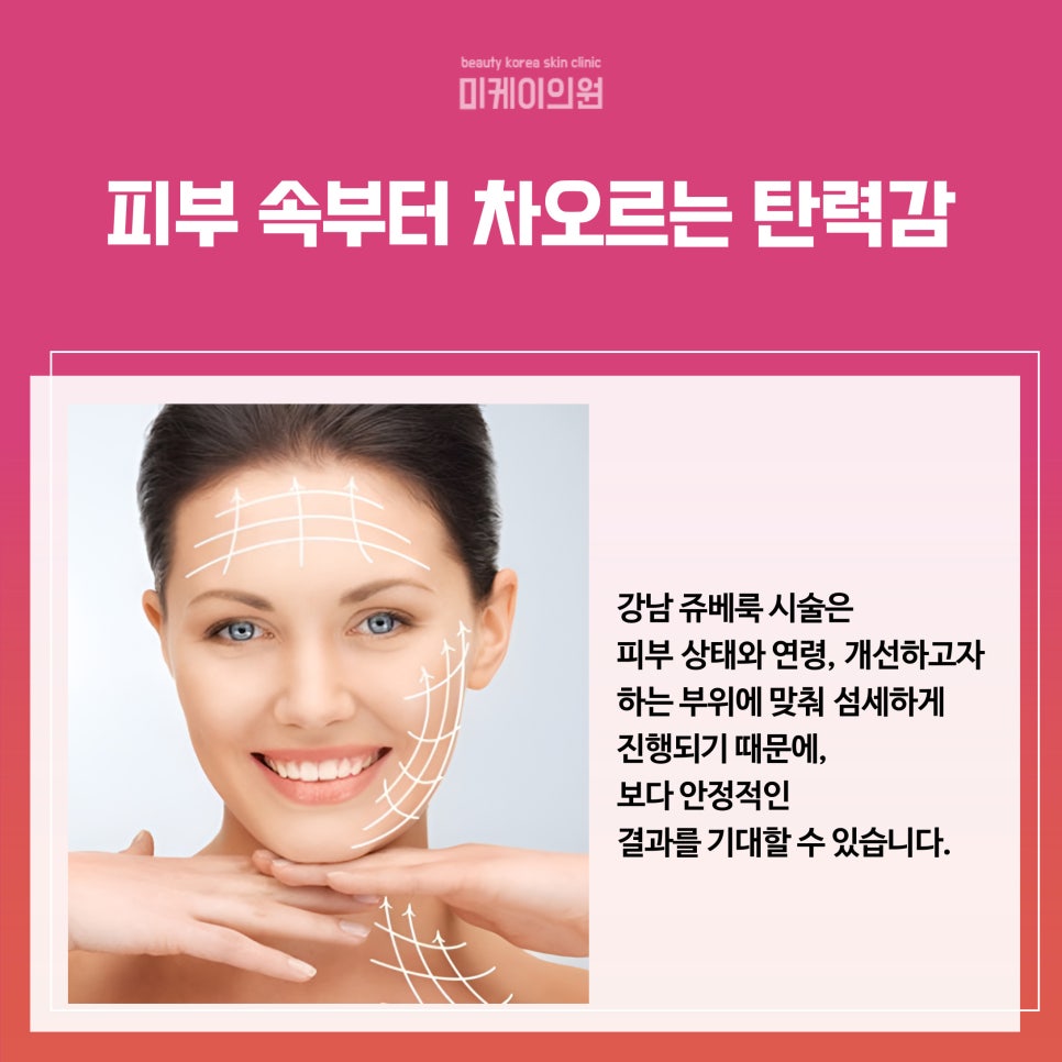 Natural Lifting with Gangnam Juvelook image 2