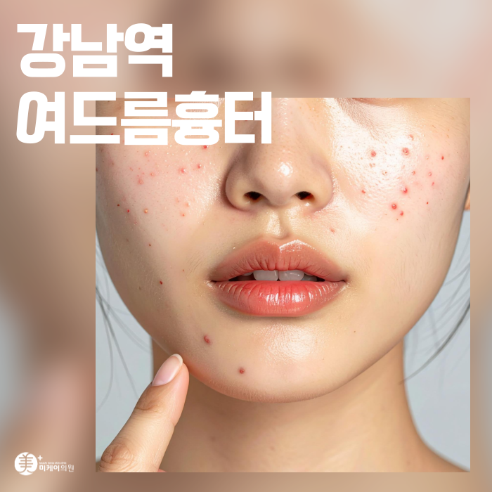 강남역 여드름흉터 매끈하게 채우는 법 관련 이미지 1