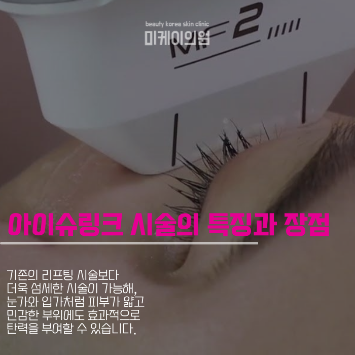 A Specialized Procedure for Firmness: Gangnam Eye Shrink image 2