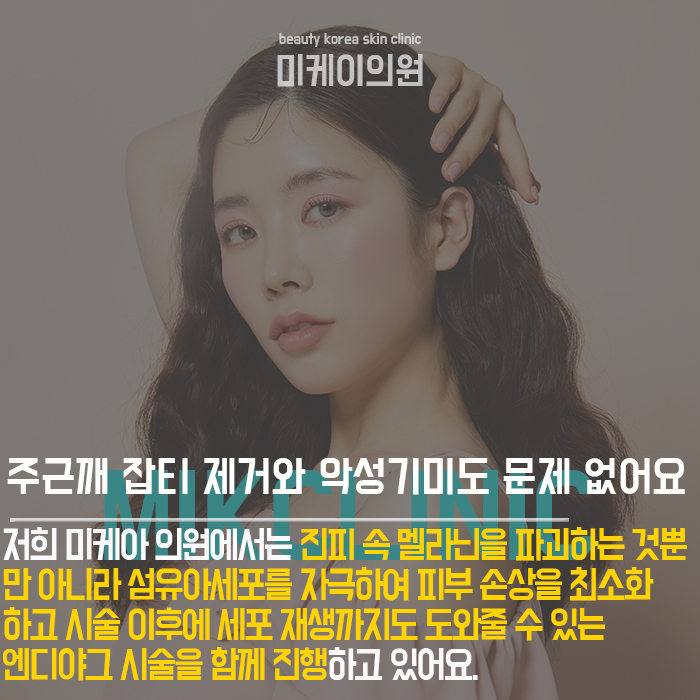 칙칙한피부원인 내 피부톤이 어두운 이유 관련 이미지 4