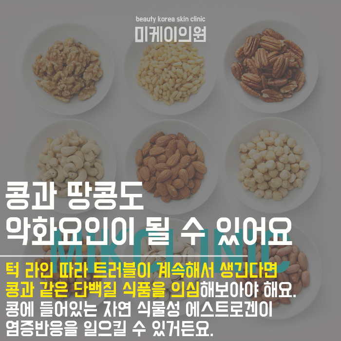 여드름에 안좋은 음식5가지 알아보고 피하자 관련 이미지 5