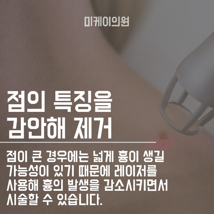 얼굴 점 위치에 따른 관상 보는 방법에 대하여 관련 이미지 4