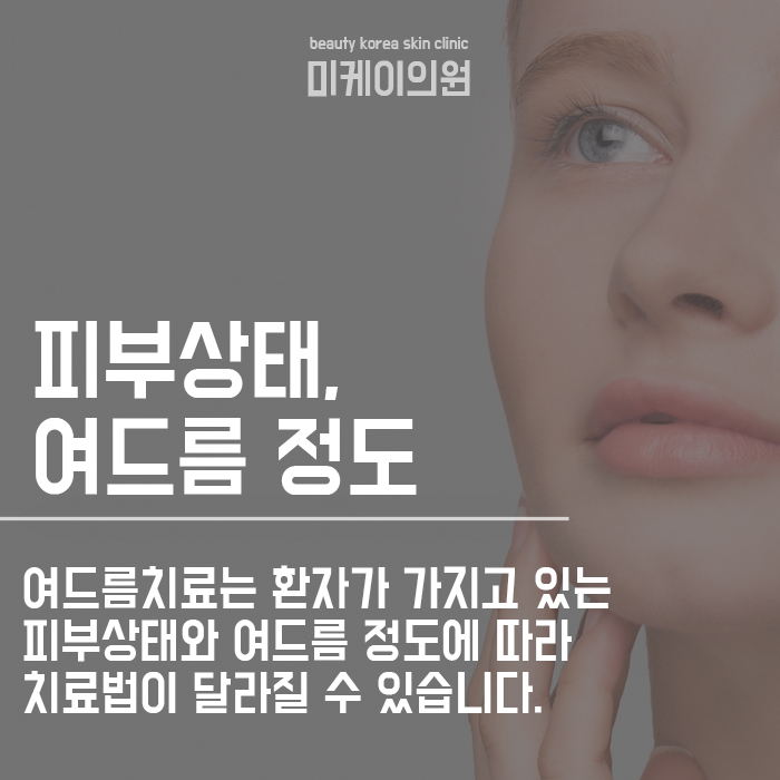 서초구 여드름흉터 걱정될때는 관련 이미지 3