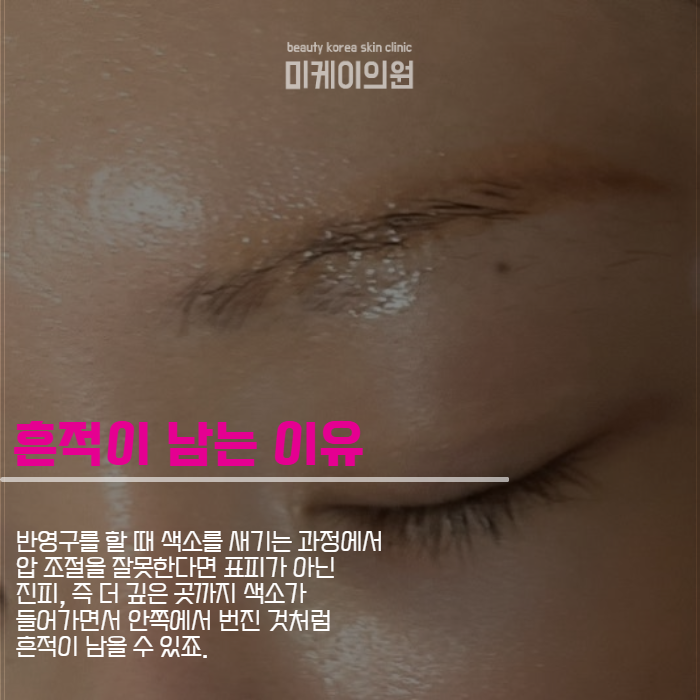 눈썹문신 잔흔없애는법 너무 신경 쓰인다면 관련 이미지 3