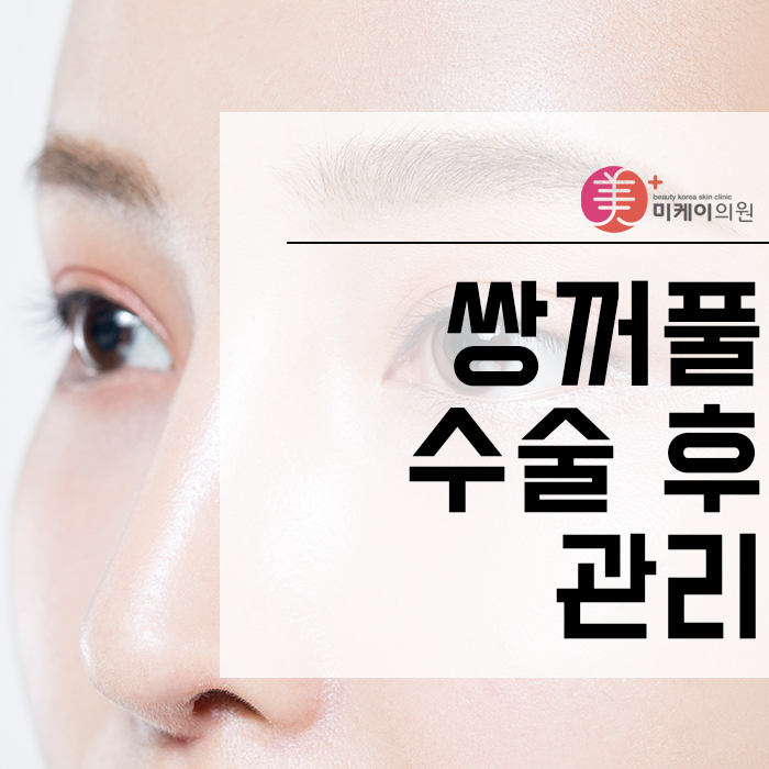 쌍꺼풀수술후관리 이것만큼은 꼭 기억하자! 관련 이미지 1