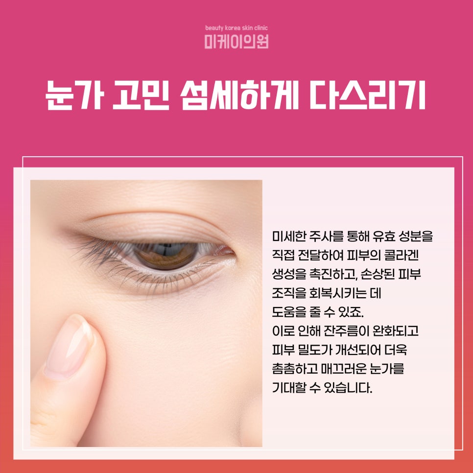 강남역 리쥬란아이 효과로 눈가에 생기를 관련 이미지 2