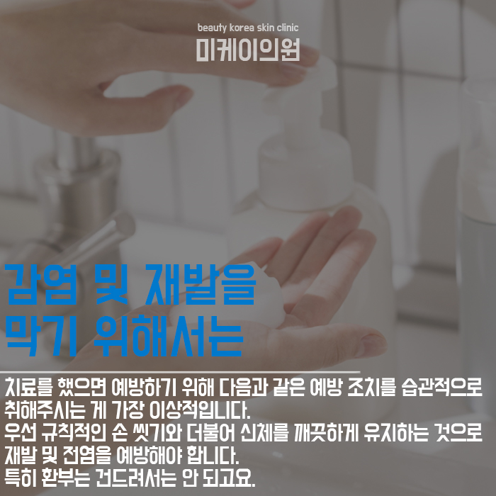 사마귀생기는이유 원인을 알고 예방해요 관련 이미지 5