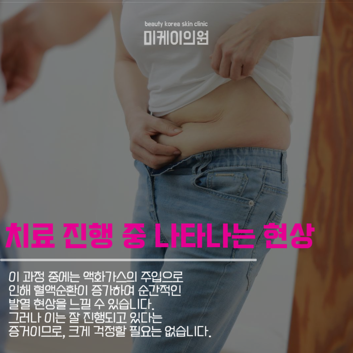 다이어트치료종류 대해서 궁금하시다면 관련 이미지 4