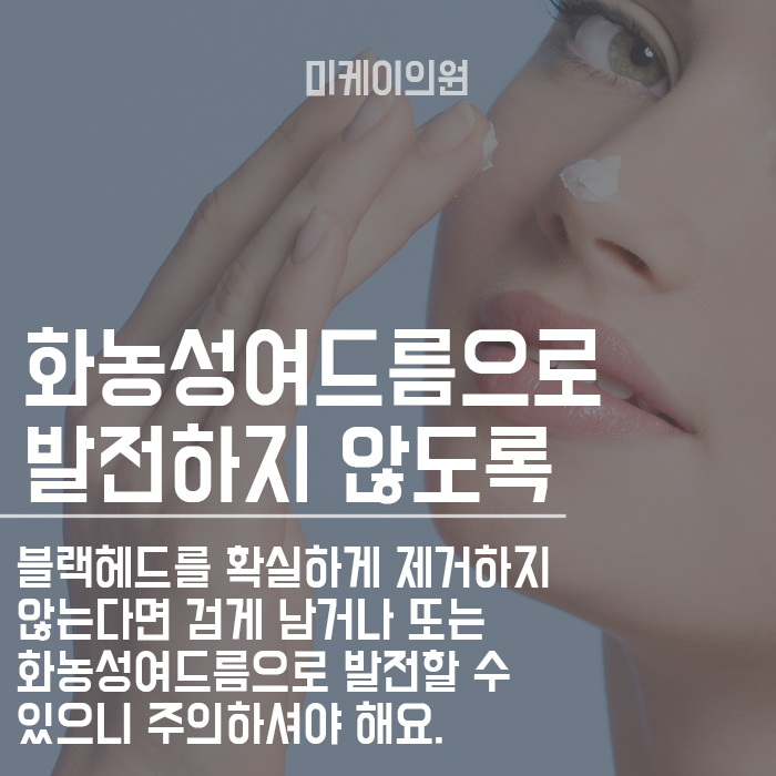 피부 콧볼피지제거 하는 방법 관련 이미지 3