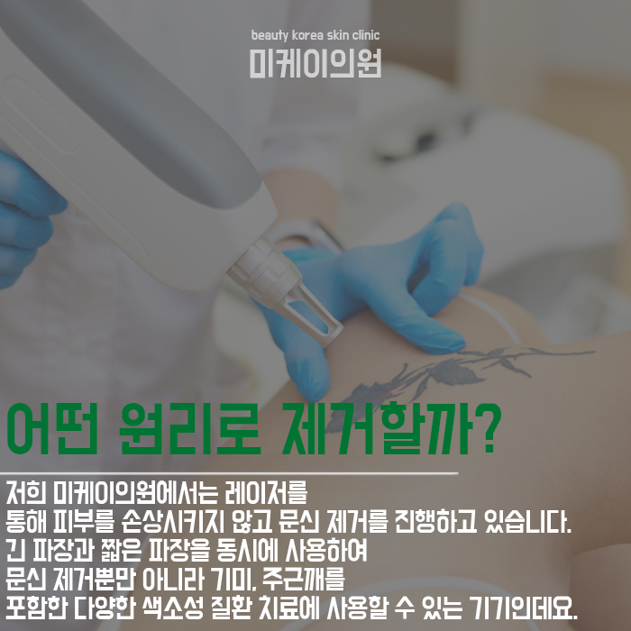 강남문신제거 후회되는 문신 지워요 관련 이미지 3