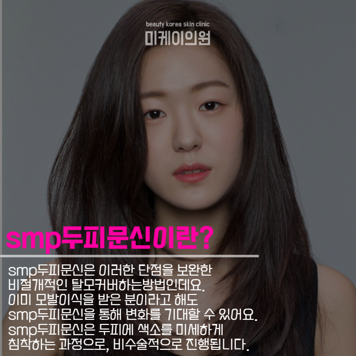탈모커버하는방법 모발이식부터 반영구까지 관련 이미지 4