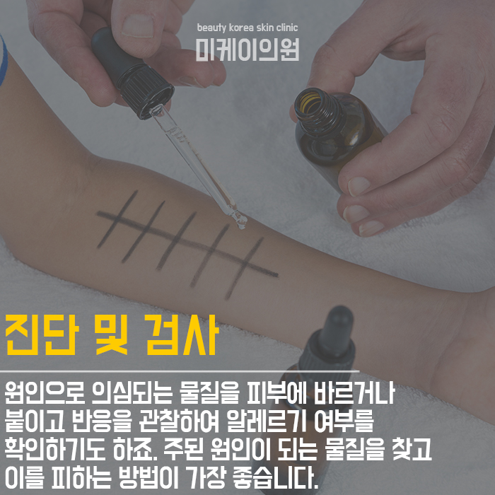 피부습진예방법 부드럽고 고운 손 만들기 관련 이미지 4