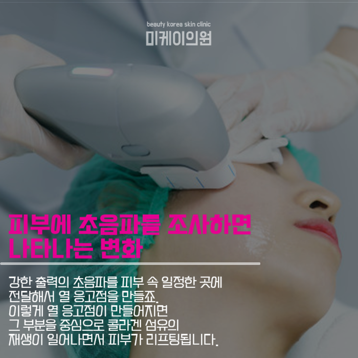 강남슈링크300샷 의미부터 원리까지 관련 이미지 4