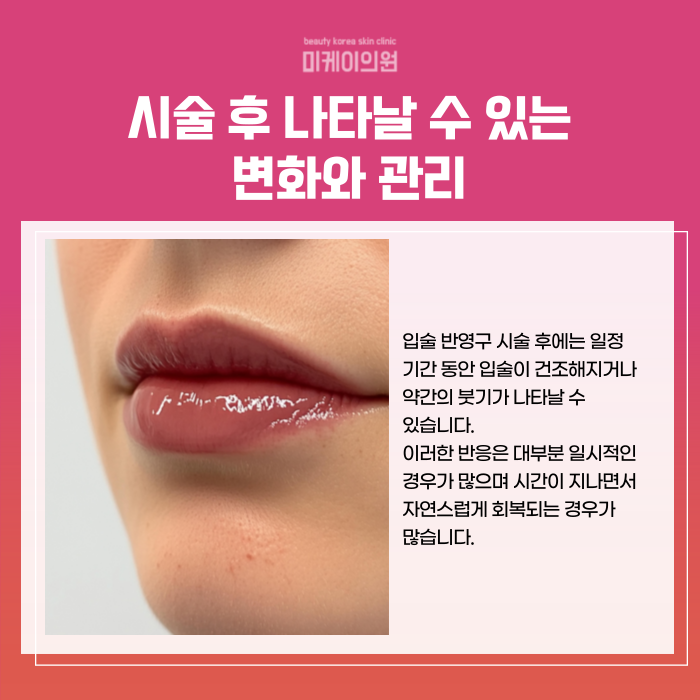 Gangnam Station Lip Semi-Permanent Makeup: Natural Lip Color image 5