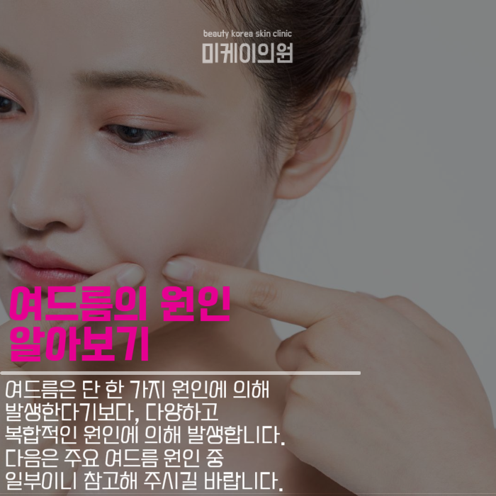 여드름종류 및 관리방법 살펴보기 관련 이미지 2