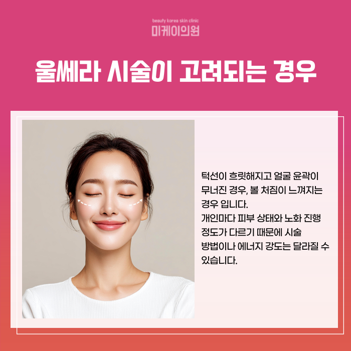 서초 울쎄라 병원 리프팅 시술의 원리와 효과 관련 이미지 3