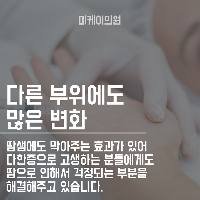 50대 눈밑주름 보톡스 매끈하게 퍼져요~ 관련 이미지 3