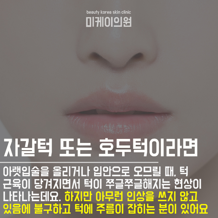 강남 자갈턱보톡스 자연스러운 변화 관련 이미지 3