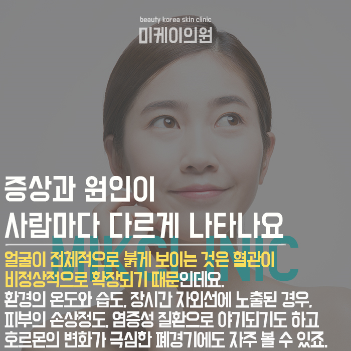 안면홍조예방하는방법 만성화가 되기 전에 관련 이미지 2
