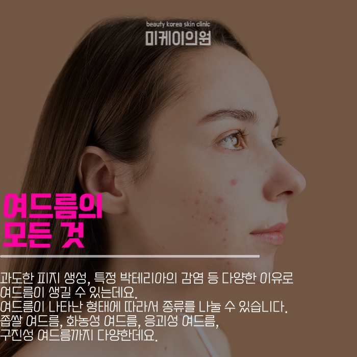 강남역여드름 본격적으로 관리하자 관련 이미지 2