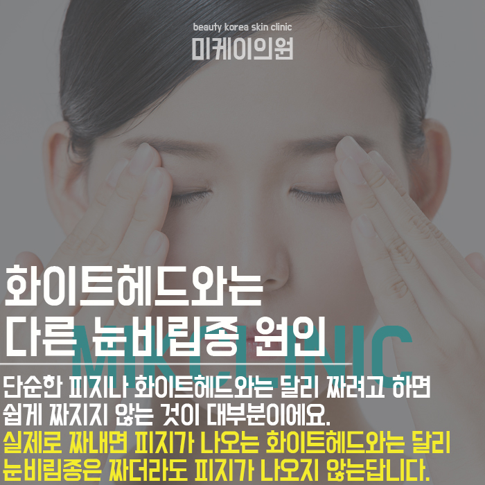 눈비립종원인 및 관리 방법 알아보자 관련 이미지 2