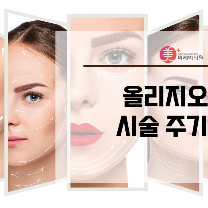 올리지오 시술 주기 궁금하셨다면 관련 이미지 1