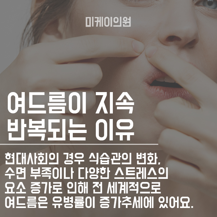 여드름없애는 관리방법 관련 이미지 2