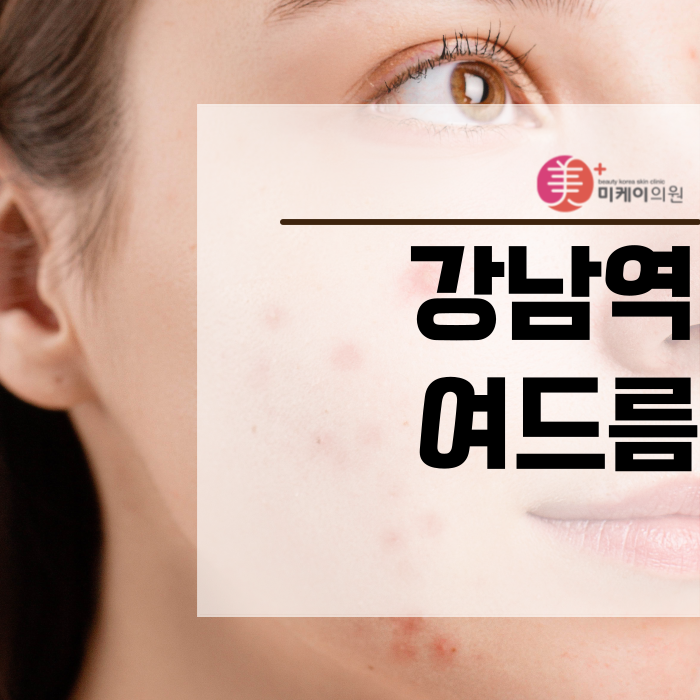 강남역여드름 본격적으로 관리하자 관련 이미지 1