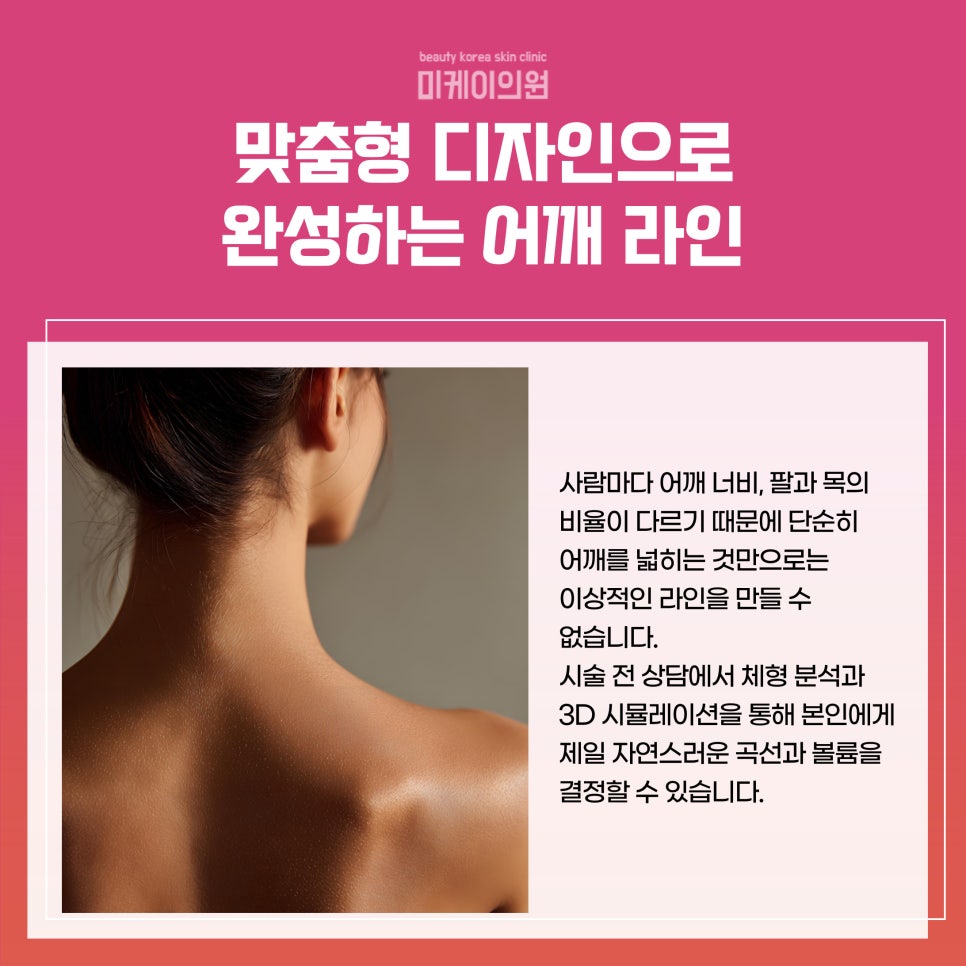 Natural and Balanced Shoulder Lines with Shoulder Filler Near Gangnam Station image 2