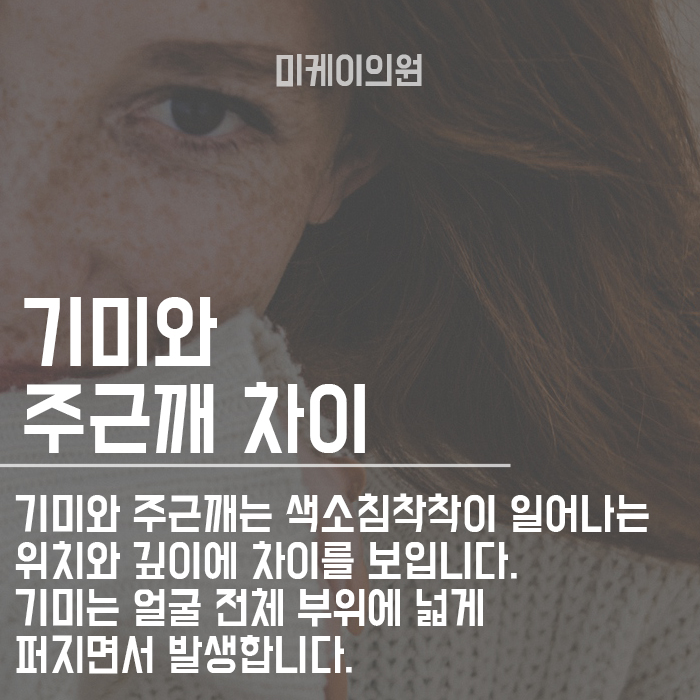 기미주근깨없애는방법 깨끗한 피부를 위한 관리 관련 이미지 2