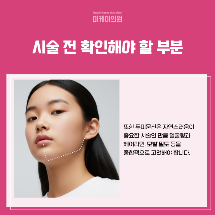 강남역 두피문신 자연스러운 빽빽한 헤어라인 관련 이미지 4