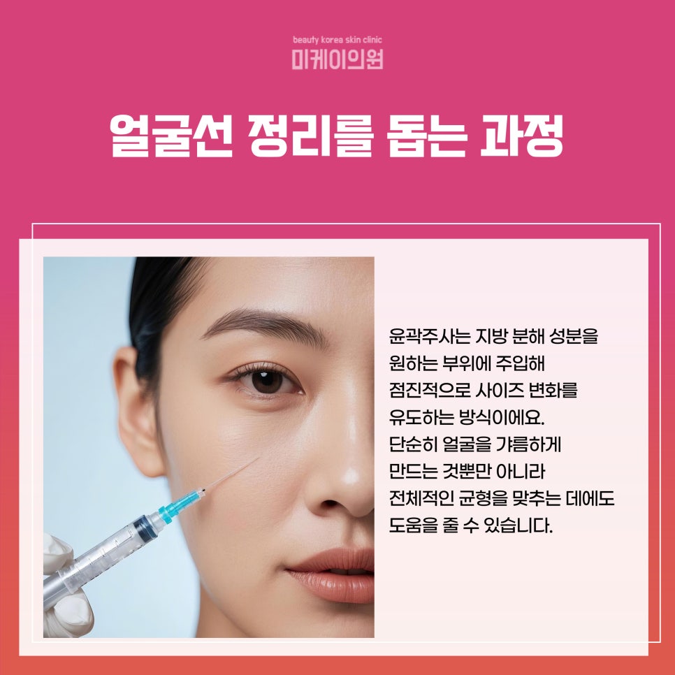 강남 윤곽주사 시술 얼굴선을 부드럽게 다듬는 선택 관련 이미지 2