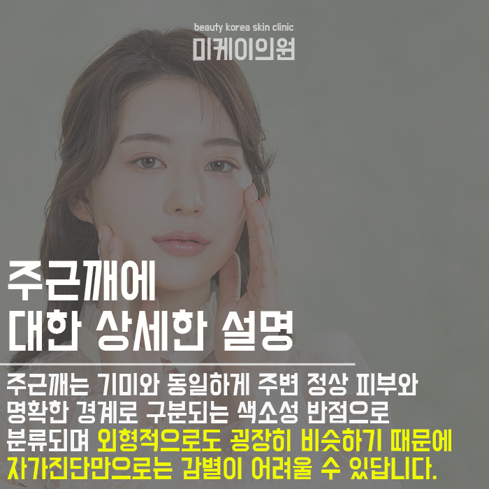서초주근깨치료 자꾸 여기를 찾는 이유 관련 이미지 3