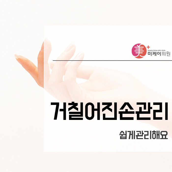 거칠어진손관리 쉽게관리해요 관련 이미지 1