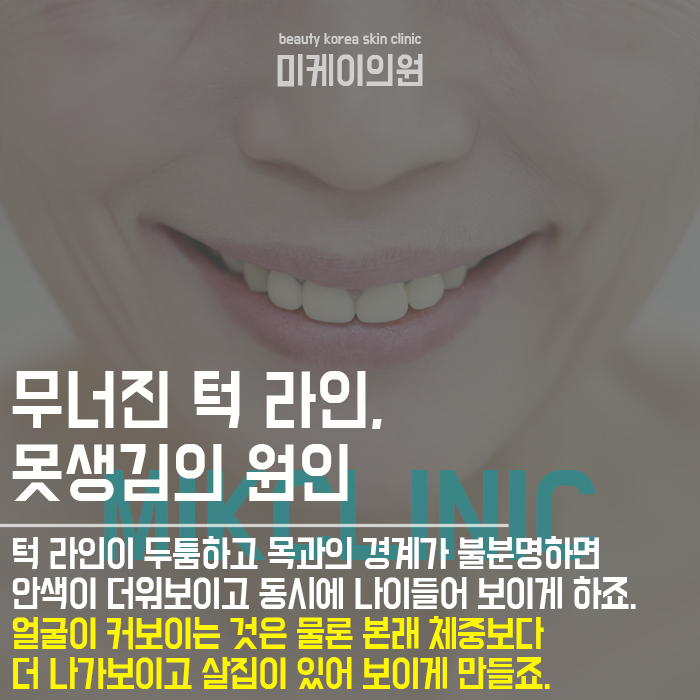 턱살보톡스효과 이중턱 없애고 또렷한 라인을 관련 이미지 2