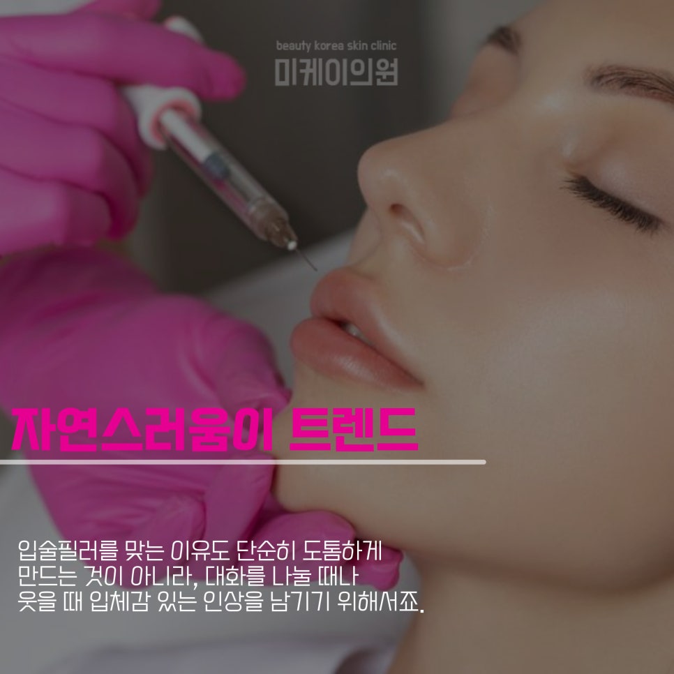 How to Avoid Swelling as a Lip Filler Side Effect image 5