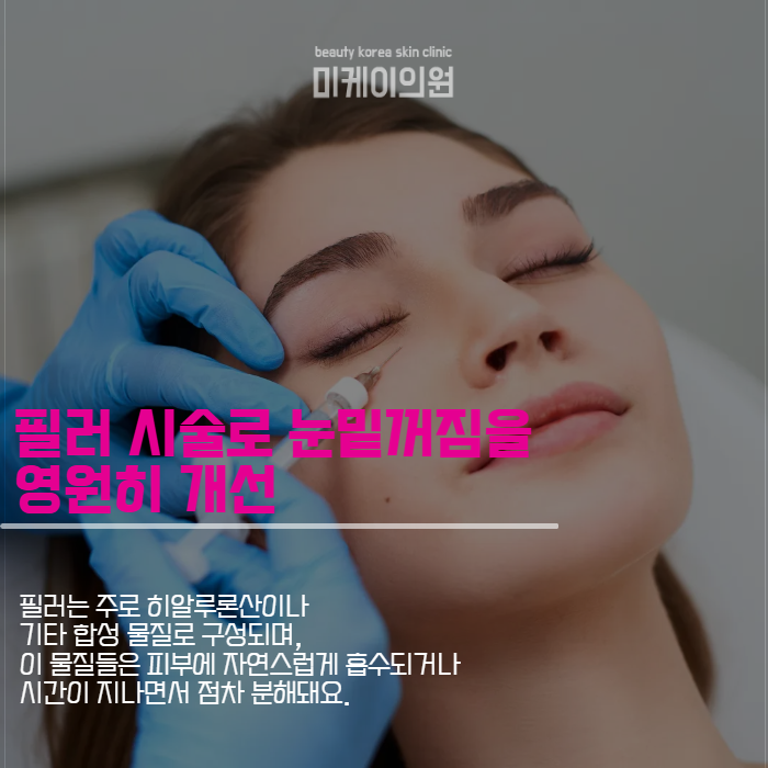 눈밑꺼짐시술 종류가 궁금하다면 관련 이미지 4