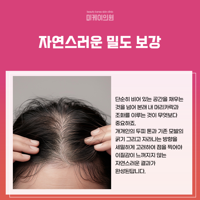 If You’re Concerned About a Thin Crown in Gangnam Seocho SMP image 2