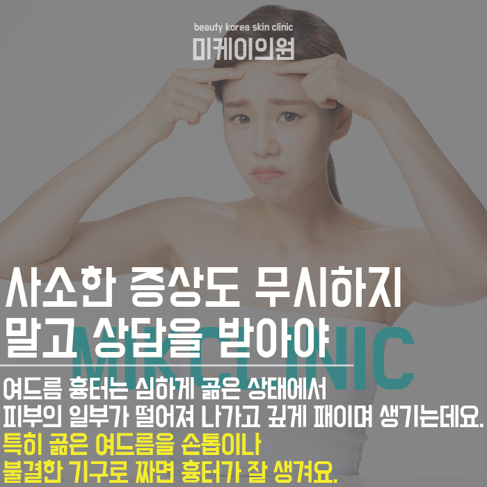 서초여드름흉터치료 변화가 눈에 보여요 관련 이미지 3